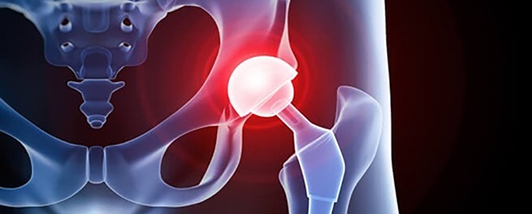 VGF (Valoración Geriátrica Funcional-App)