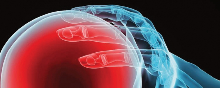 Dispositivo de medición de presión intracraneal