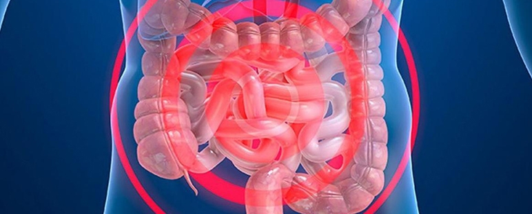 Test diagnóstico fecal para la detección de la permeabilidad intestinal.