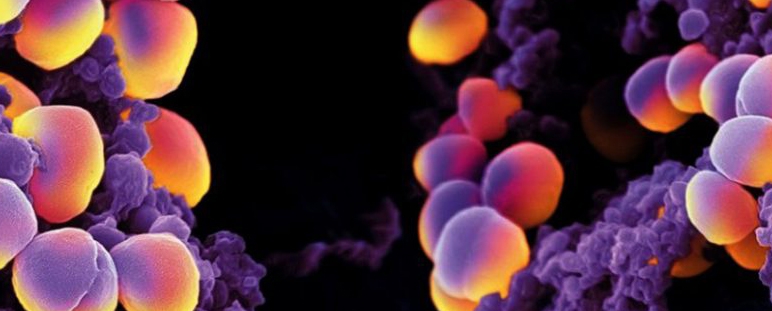 Nuevo método de detección de procesos infecciosos mediante imagen nuclear. 