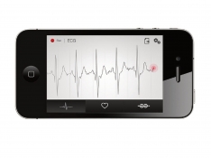 App de interpretación de ECG