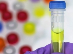 Nuevo método para diagnóstico de cáncer de vejiga.