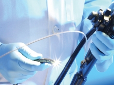Dispositivos para endoscopia